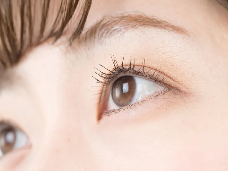 外科的涙袋形成術