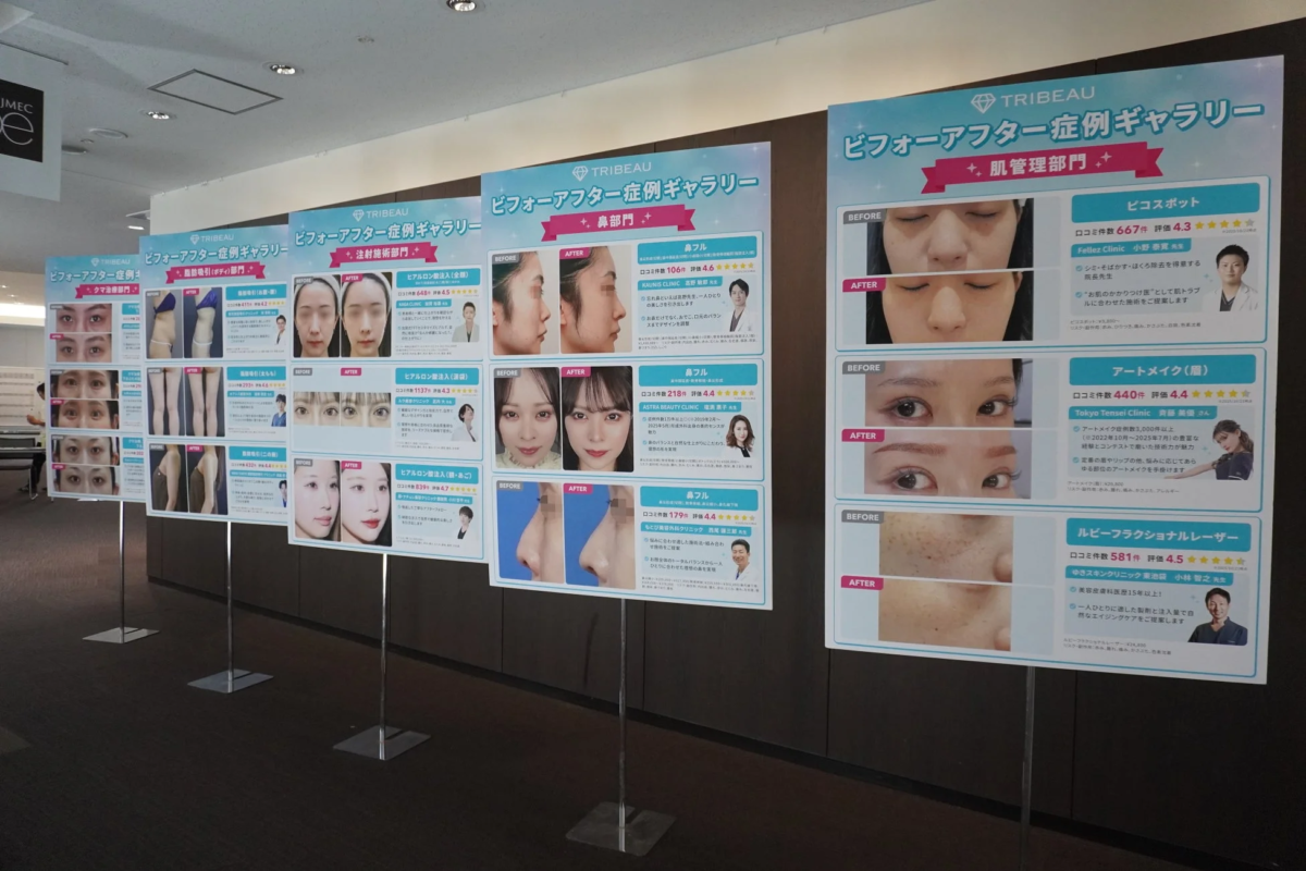美容医療の症例ギャラリーの展示