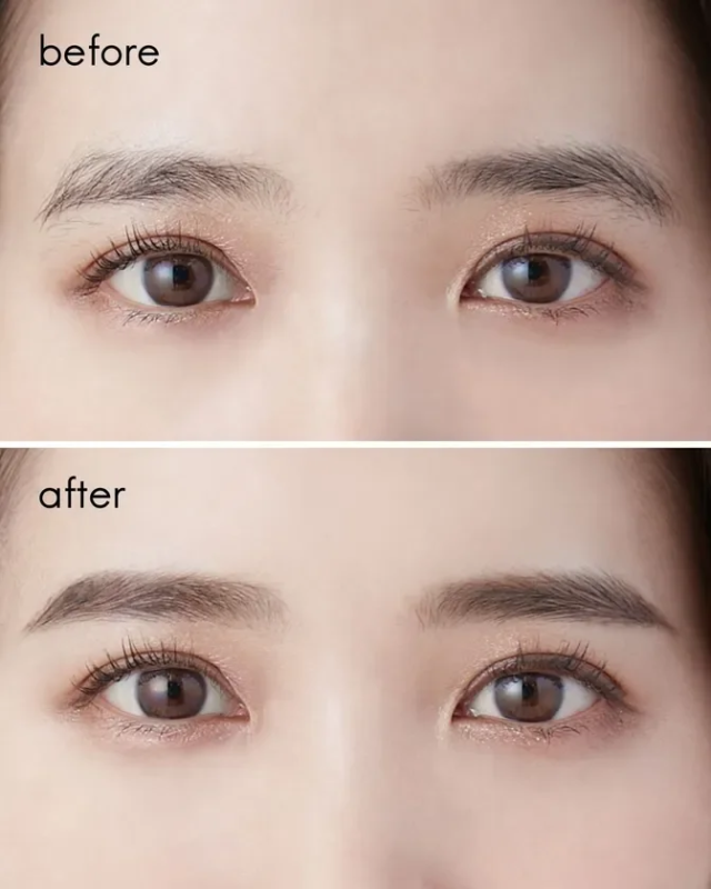 眉カットビフォーアフター