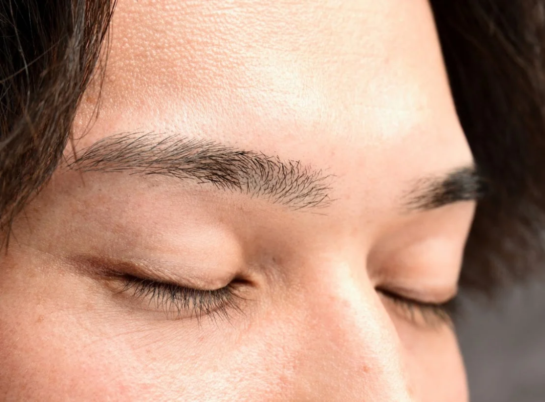 施術後の目元のクローズアップ