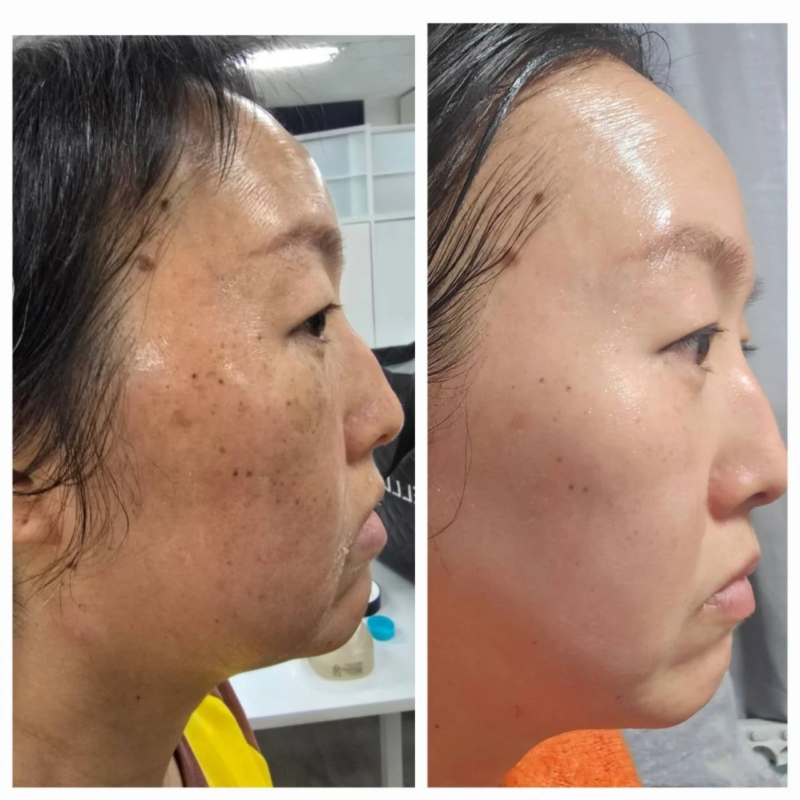 インセルダムの商品と効果のイメージ