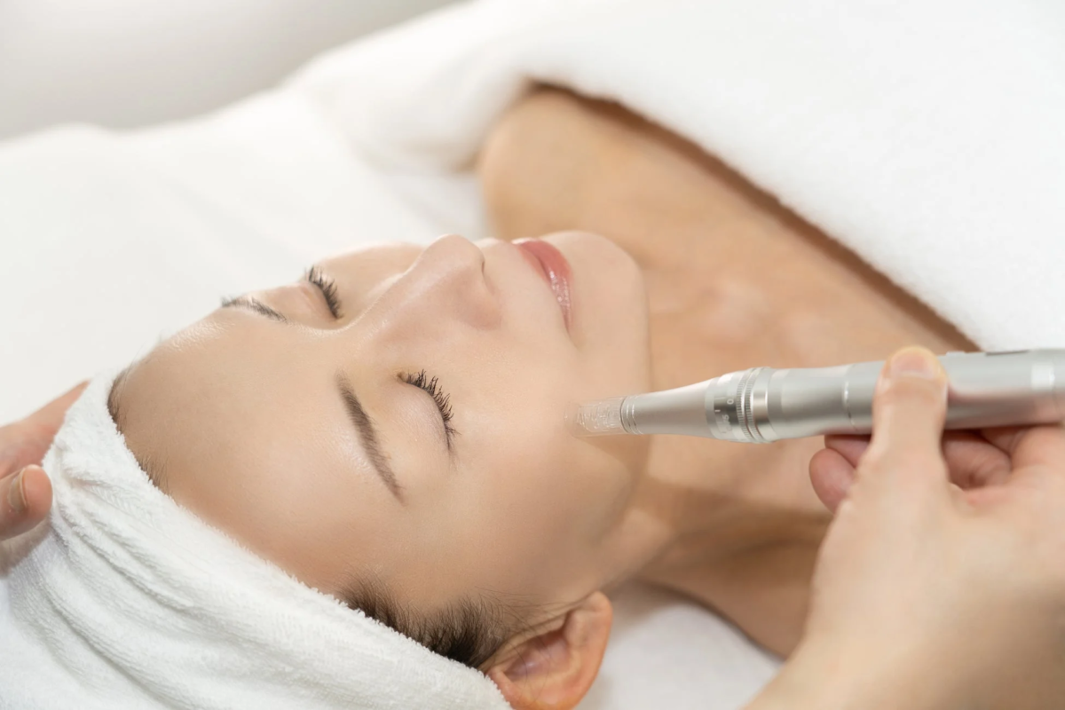 「スパトリートメント ソフトダーマペン」による施術の様子