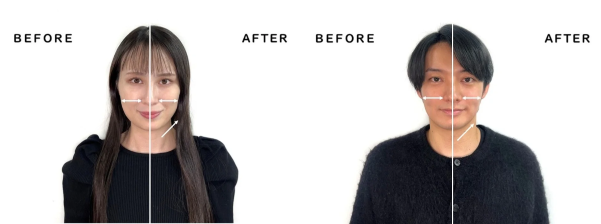 顔のビフォーアフターを比較する画像