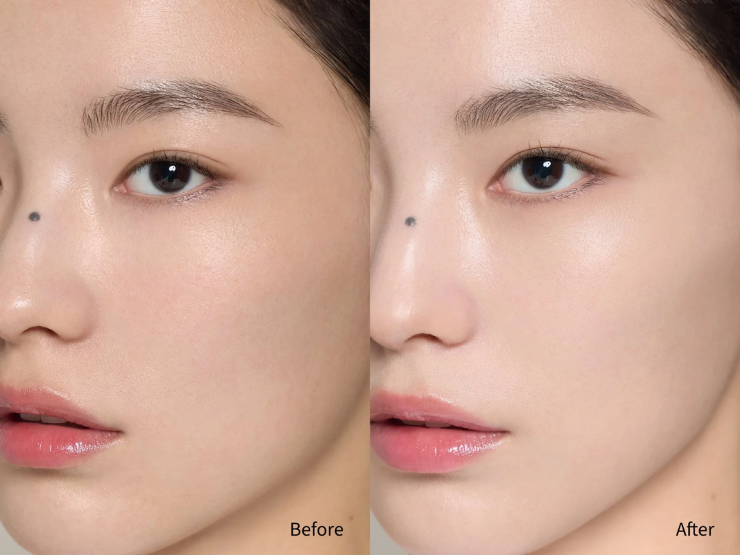 Before/After比較