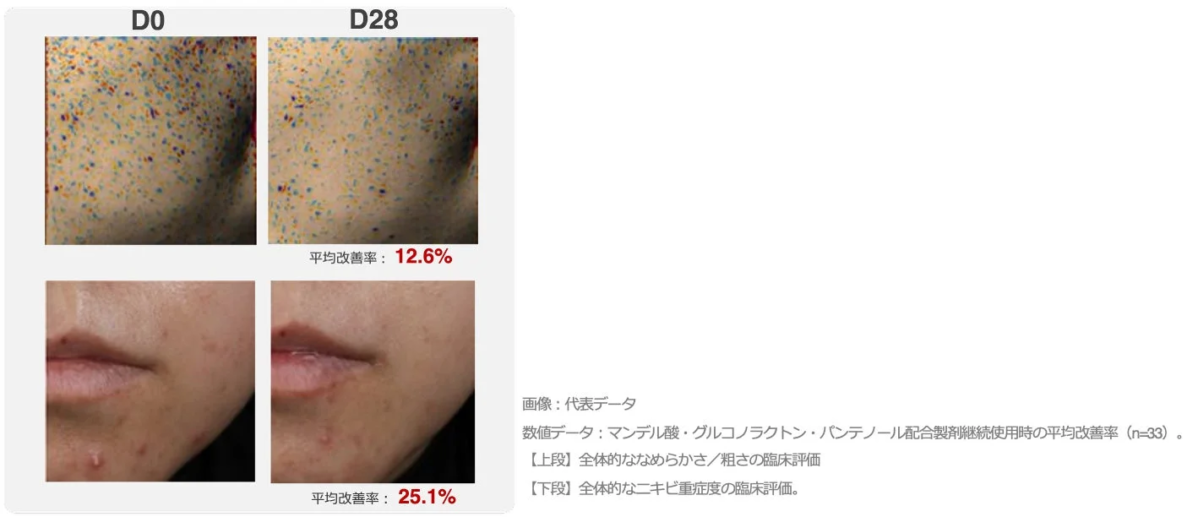 マンデル酸、グルコノラクトン、パンテノール配合製剤の臨床評価結果を示す画像