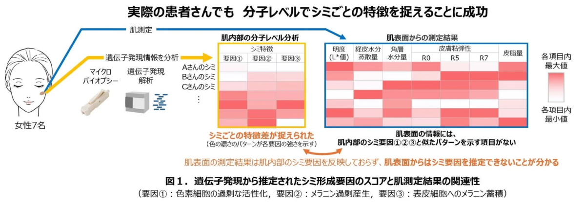 シミの分子レベル分析