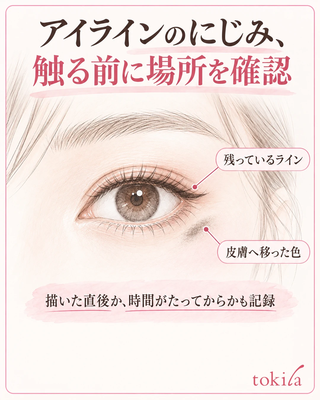 上まぶたに残るアイラインと目尻の下の皮膚へ移った色を区別する図