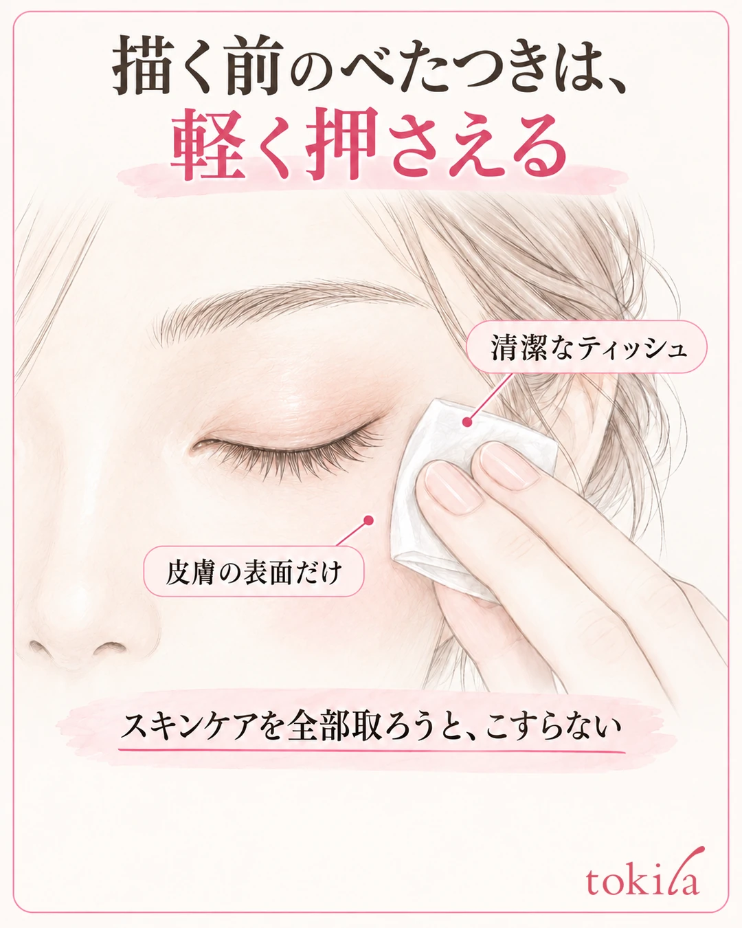 Diagram of lightly pressing the skin outside a closed eye with a clean tissue