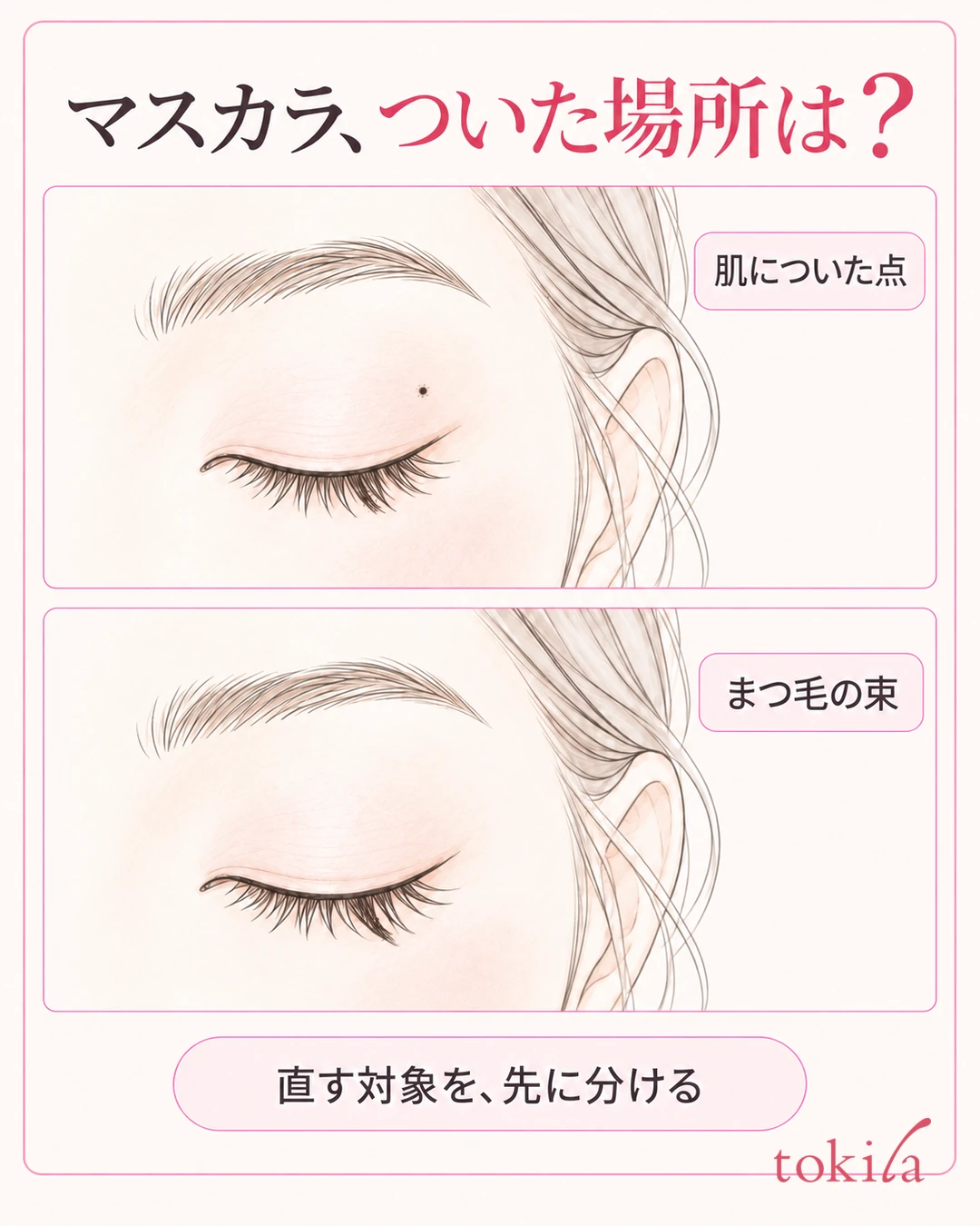 肌の点状の付着と、まつ毛の束を同じ目元で分けた観察図