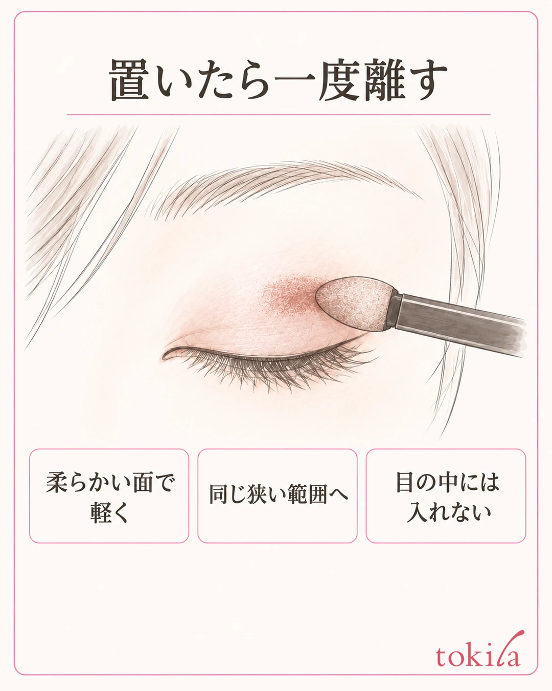 Diagram of lightly touching the soft face of a sponge tip to a narrow area of the upper lid