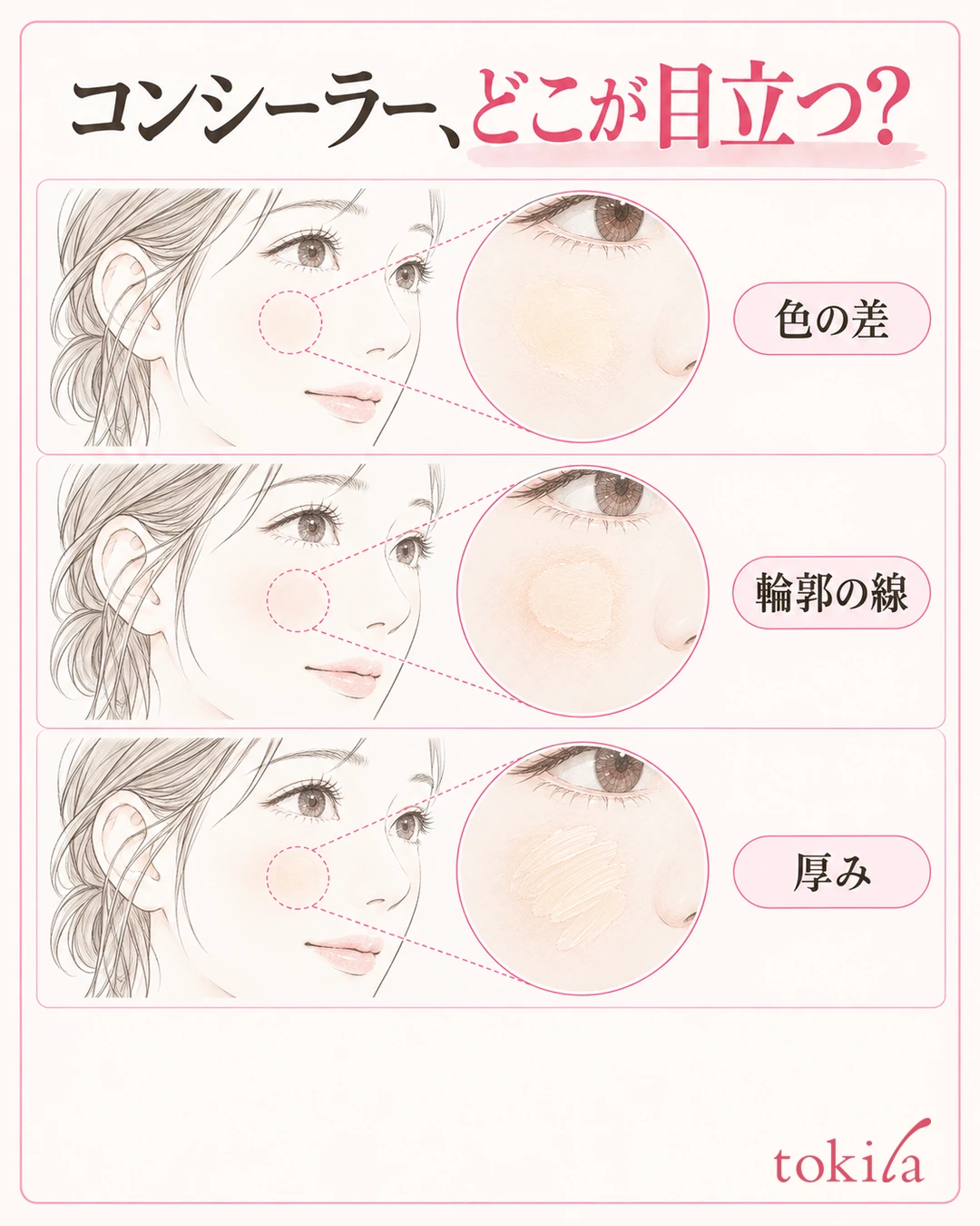 同じ頬の局所でコンシーラーの色の差・輪郭の線・厚みを分けた観察図