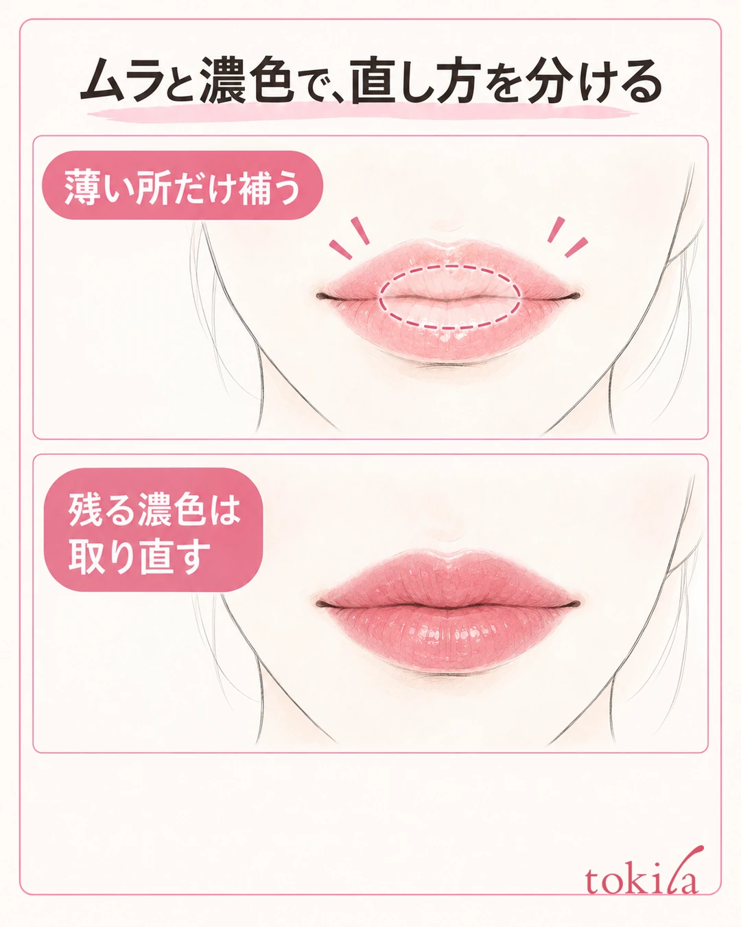 A diagram that separates how to fix lips with only a light center from lips with dark color remaining overall