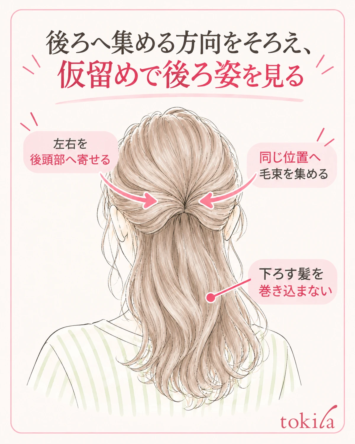 把左右聚拢到同一位置,临时固定,也确认后脑勺。