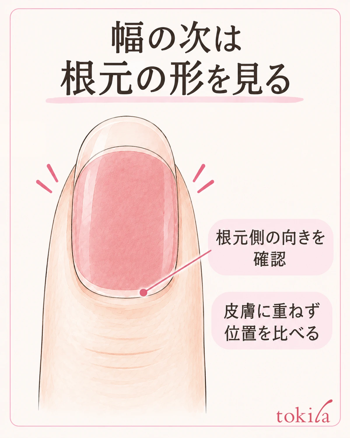 뿌리 쪽 방향을 확인하고, 스티커의 곡선이 피부에 겹치지 않는 위치를 비교한다.