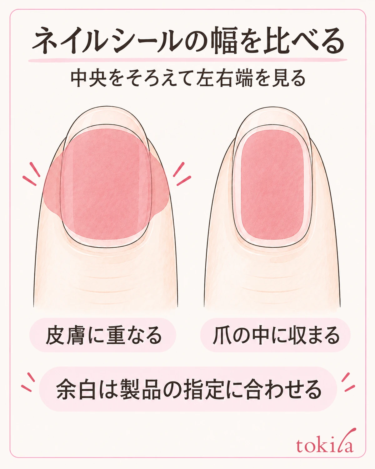 중앙을 맞추고 좌우 끝을 비교하며, 피부에 겹치는 것과 위치의 어긋남을 나누어 확인한다.