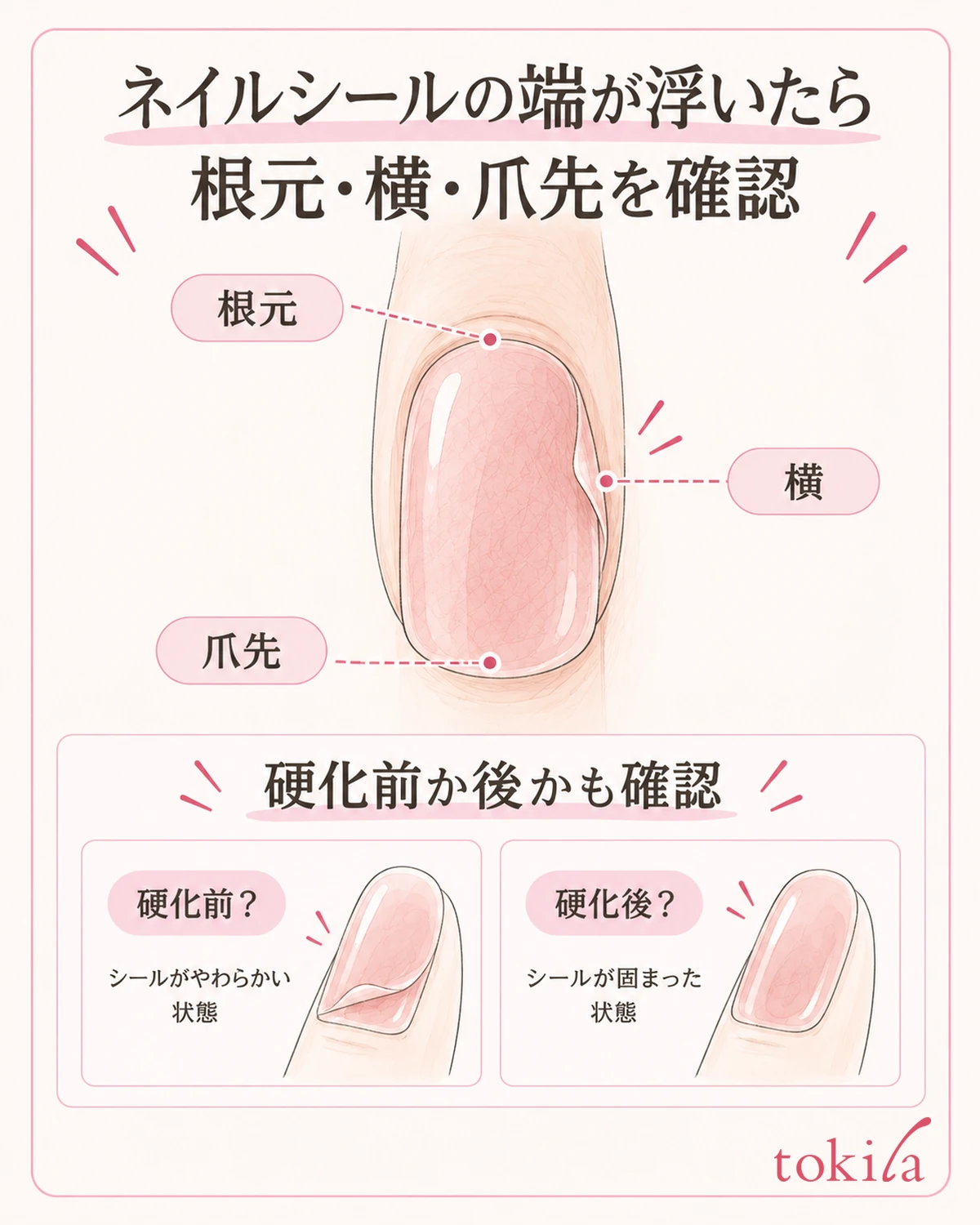 뿌리·옆·끝 중 어느 위치인지와, 경화 전후 중 어느 단계인지를 나누어 확인합니다.