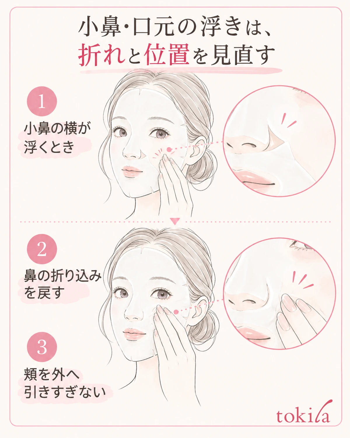 小鼻の横の浮きは、シートの折れと引っ張りを見直す。