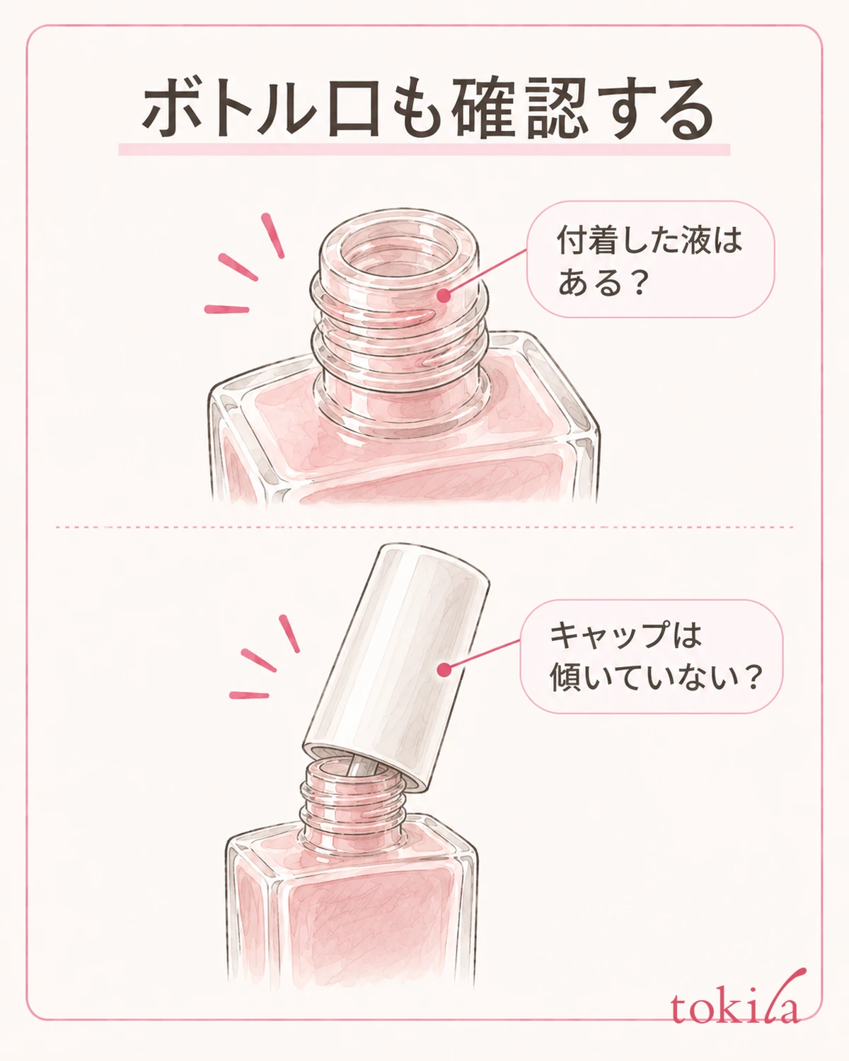 Check the buildup at the bottle mouth and the tilt of the cap before forcing it to turn.
