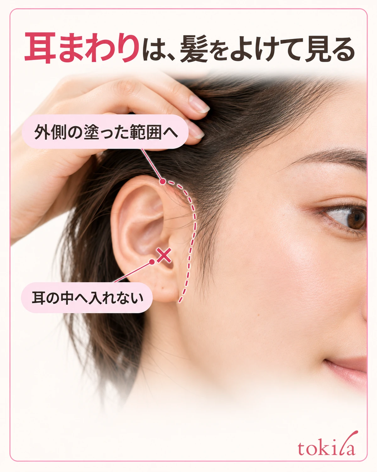 髪が覆う境目と、耳の外側の皮膚