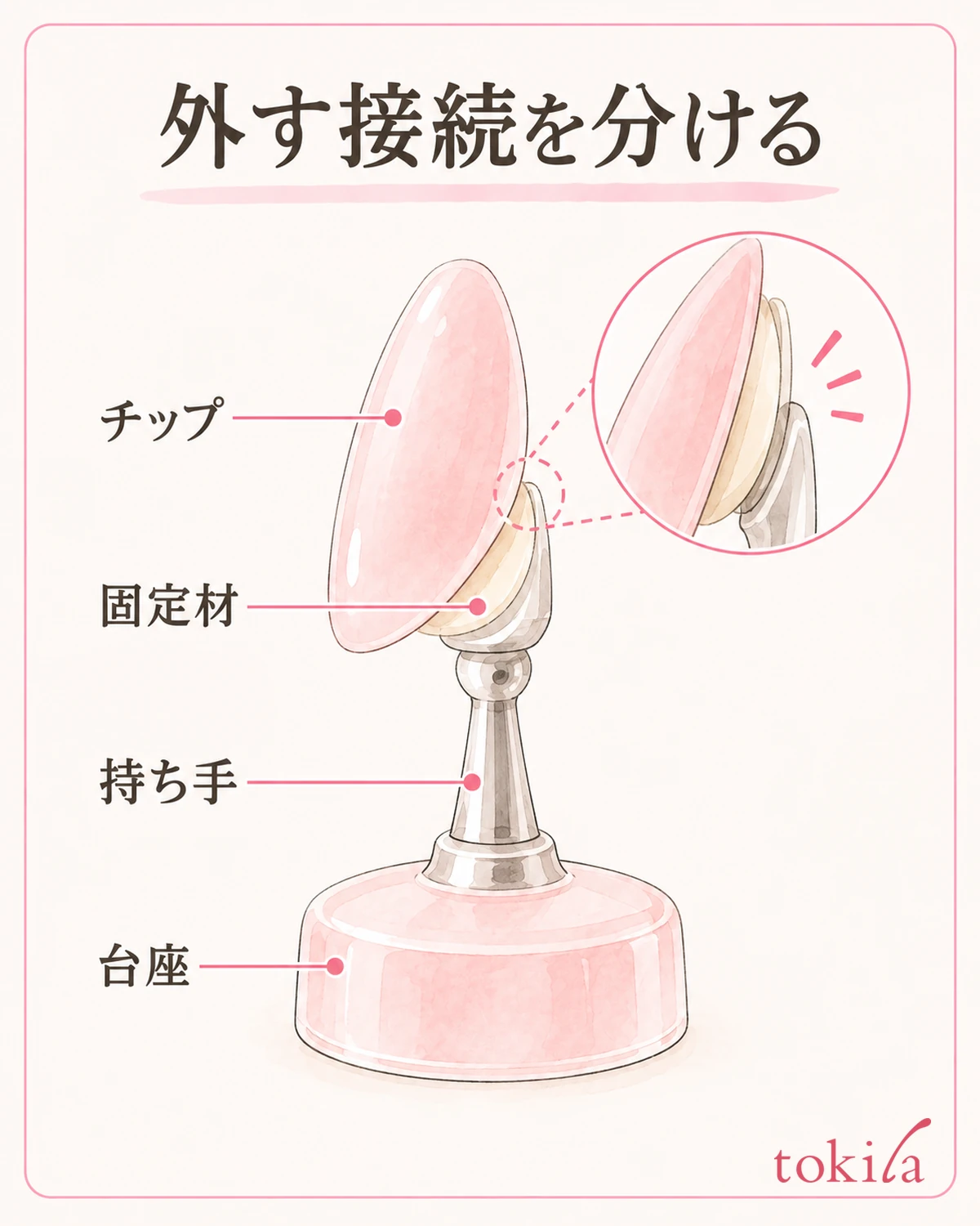 Look at the tip's fixing part and the handle-to-base connection separately.