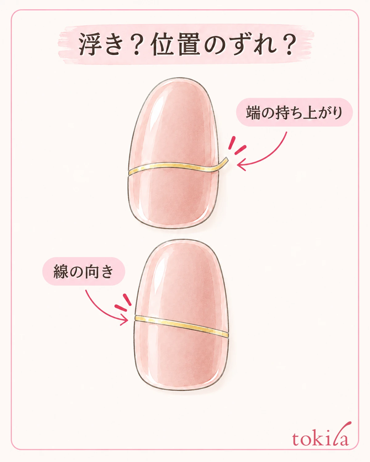 端の浮きと線の位置のずれを分けて見ます。