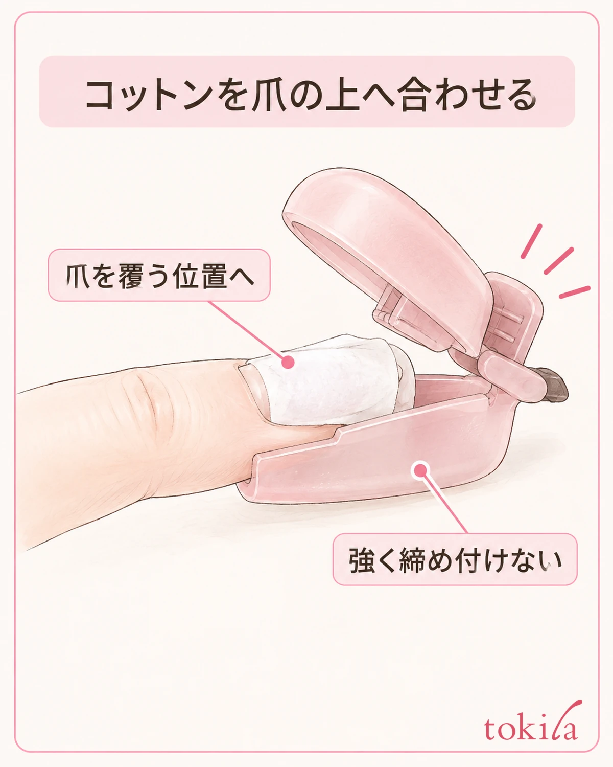 コットンを爪の上に合わせ、無理なく留まる位置へ置きます。