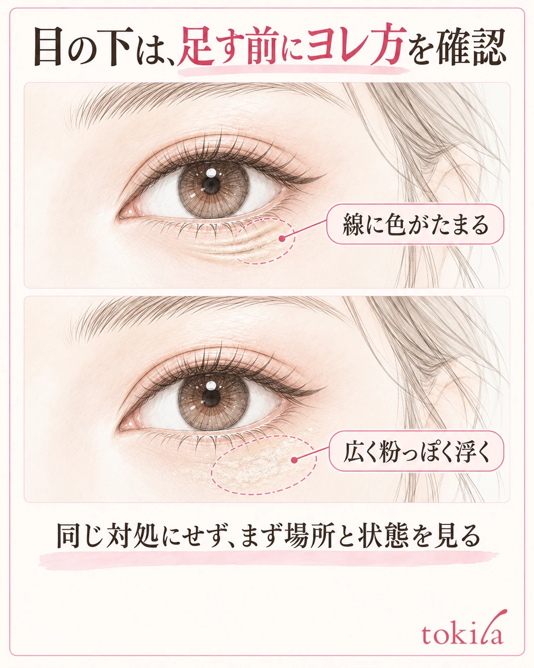 눈 밑 선에 색이 끼는 상태와 푸석하게 들뜨는 상태를 구분해 보여 주는 그림