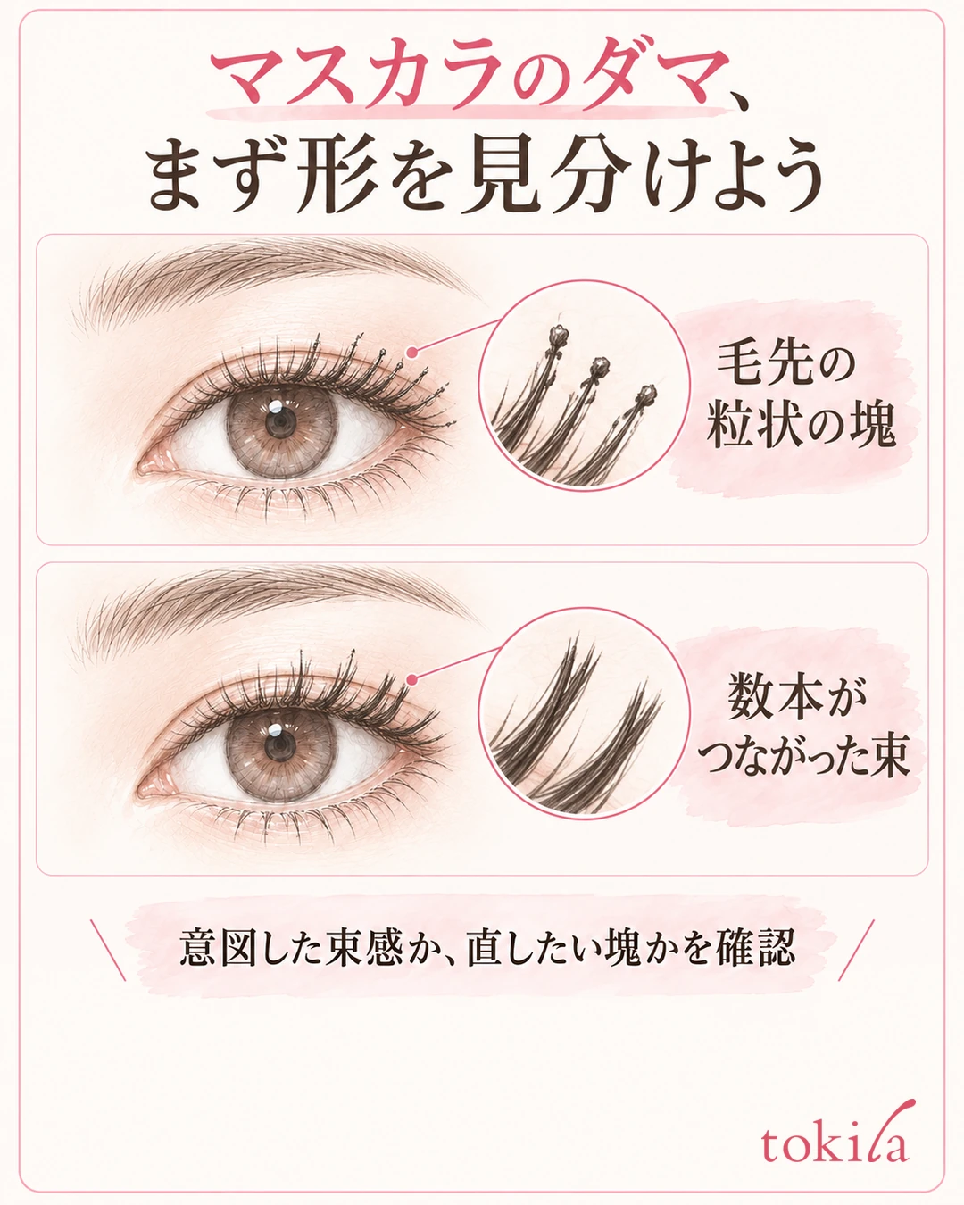 속눈썹 끝에 알갱이 모양의 덩어리가 있는 상태와 여러 가닥의 속눈썹이 다발이 된 상태를 비교하는 그림
