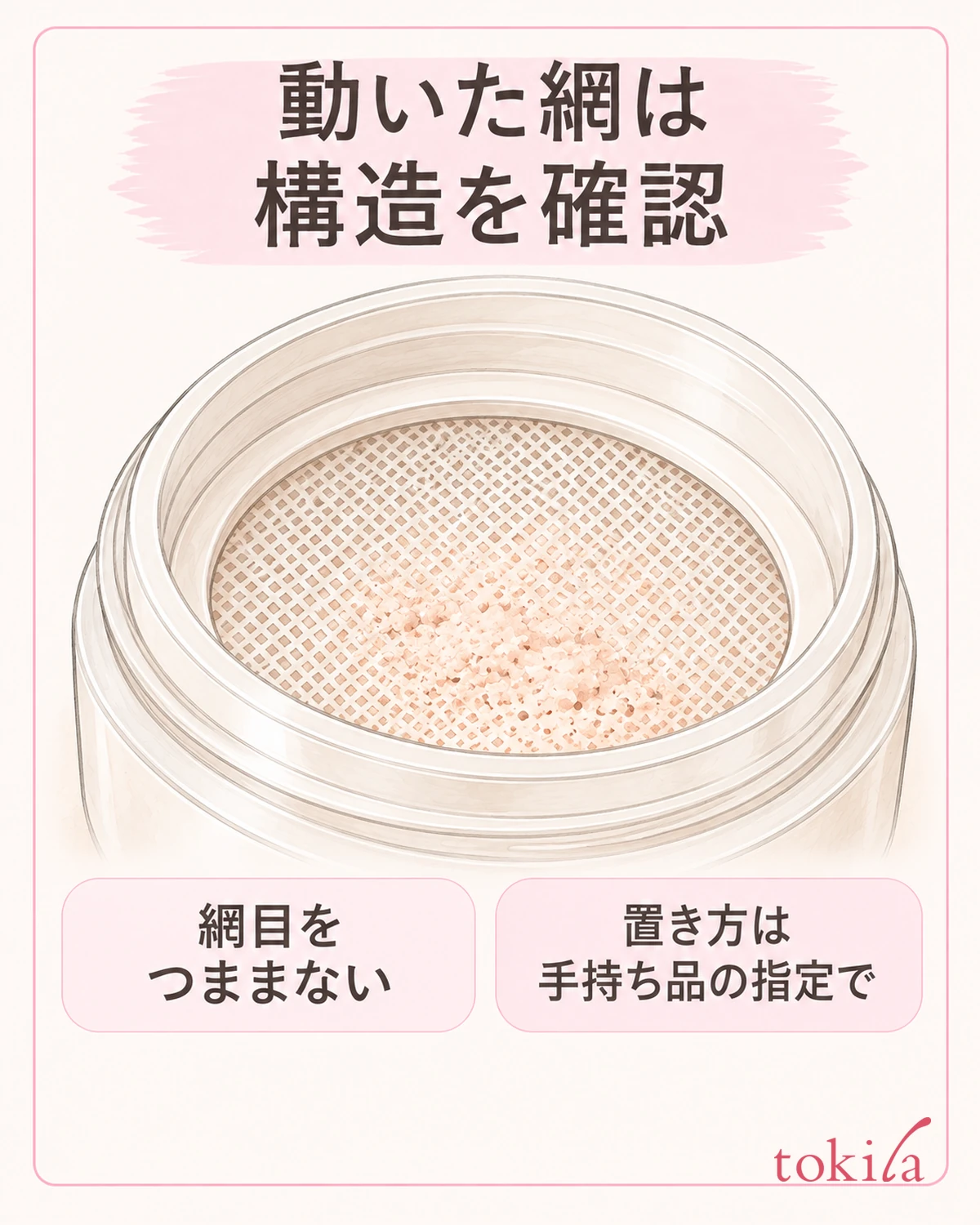 網と枠を分け、置く方式か固定する方式かを確認します。