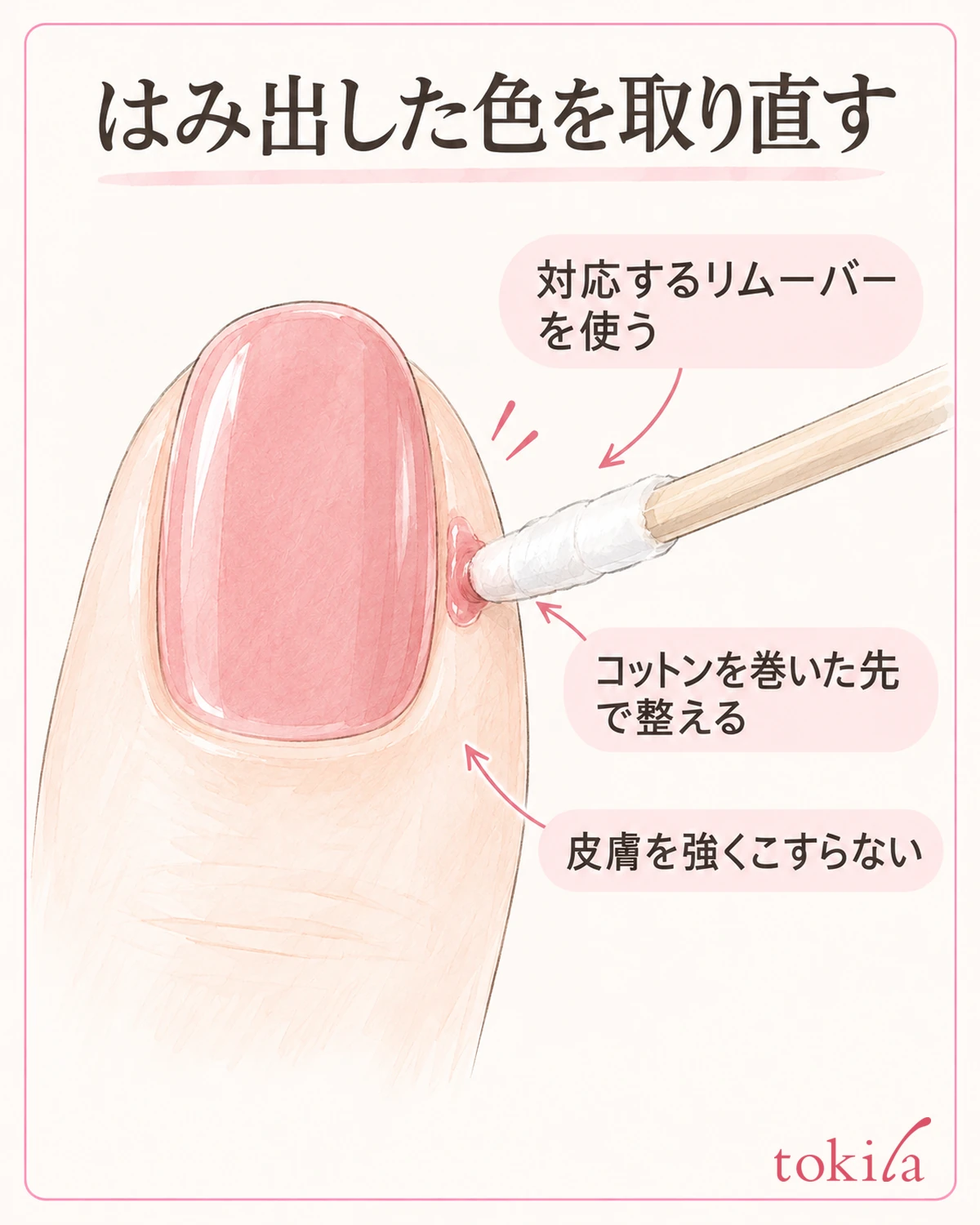 対応するリムーバーを使い、コットンを巻いた先で狭い範囲を整えます。皮膚を強くこすりません。