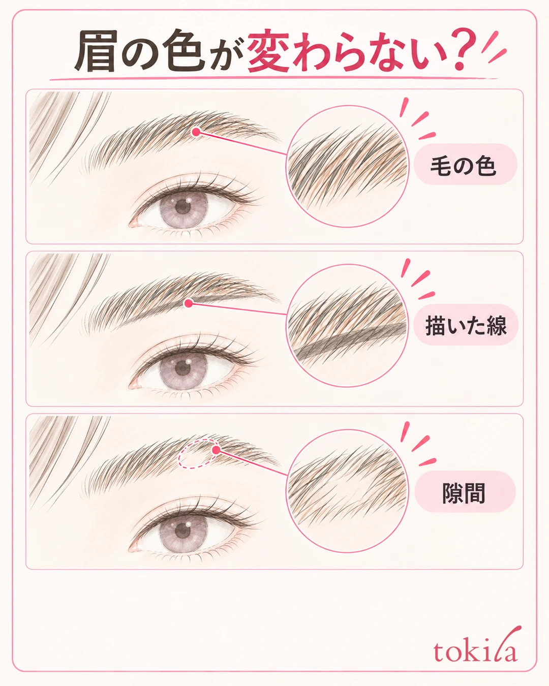 Enlarged view separating the color of the brow hairs, a line drawn on the skin and gaps with no hair